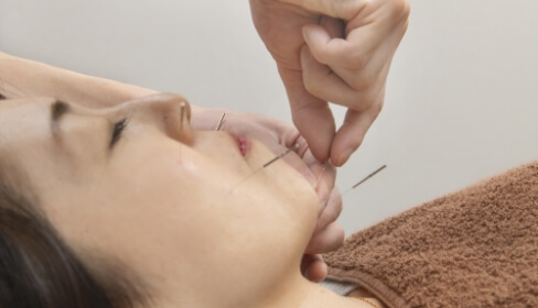 超リフトアップの施術内容1