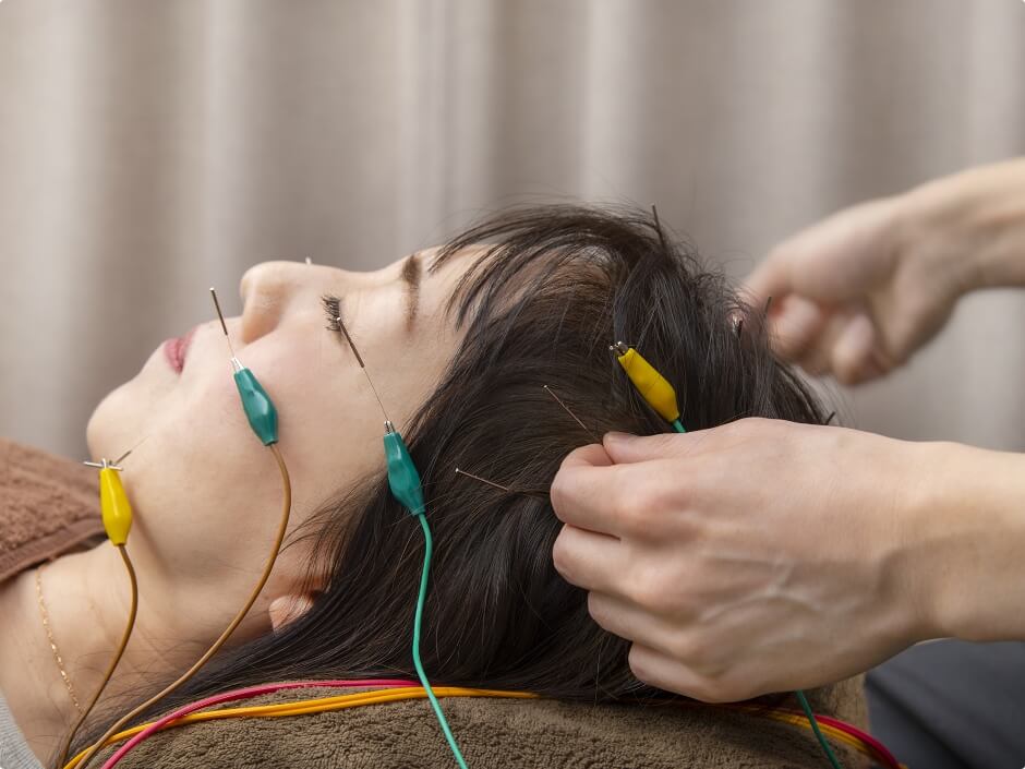 超リフトアップ