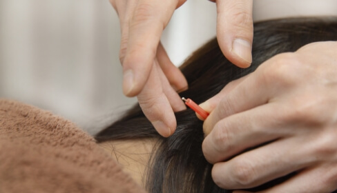 超自律神経改善の施術内容1