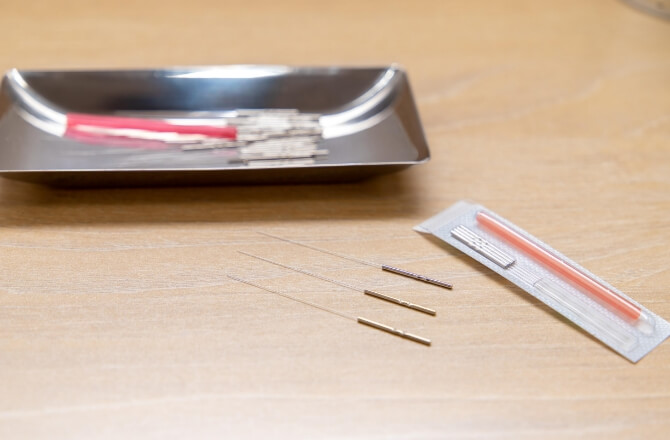 内出血しにくい0.16ミリの細い鍼を使用