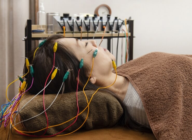 最新の美容機器で鍼の効果を向上