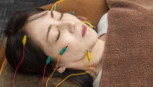 美容鍼の施術内容2